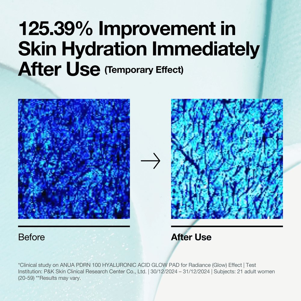 Anua PDRN 100 Hyaluronic Acid Glow Pad 180ml 60ea